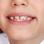 元住吉の歯医者、よしだ・ファミリー・歯科で咬合誘導の重要性について解説