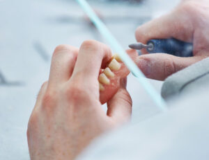 元住吉の歯医者、よしだ・ファミリー・歯科で歯がない期間を短くできる即時義歯とは？メリットとデメリットを解説