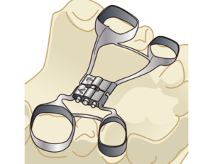 元住吉の歯医者、よしだ・ファミリー・歯科で成長発育矯正（顎顔面矯正）について解説